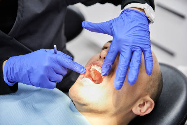 Best Emergency Treatment for Dental Infections or Abscesses in Remsen, IA